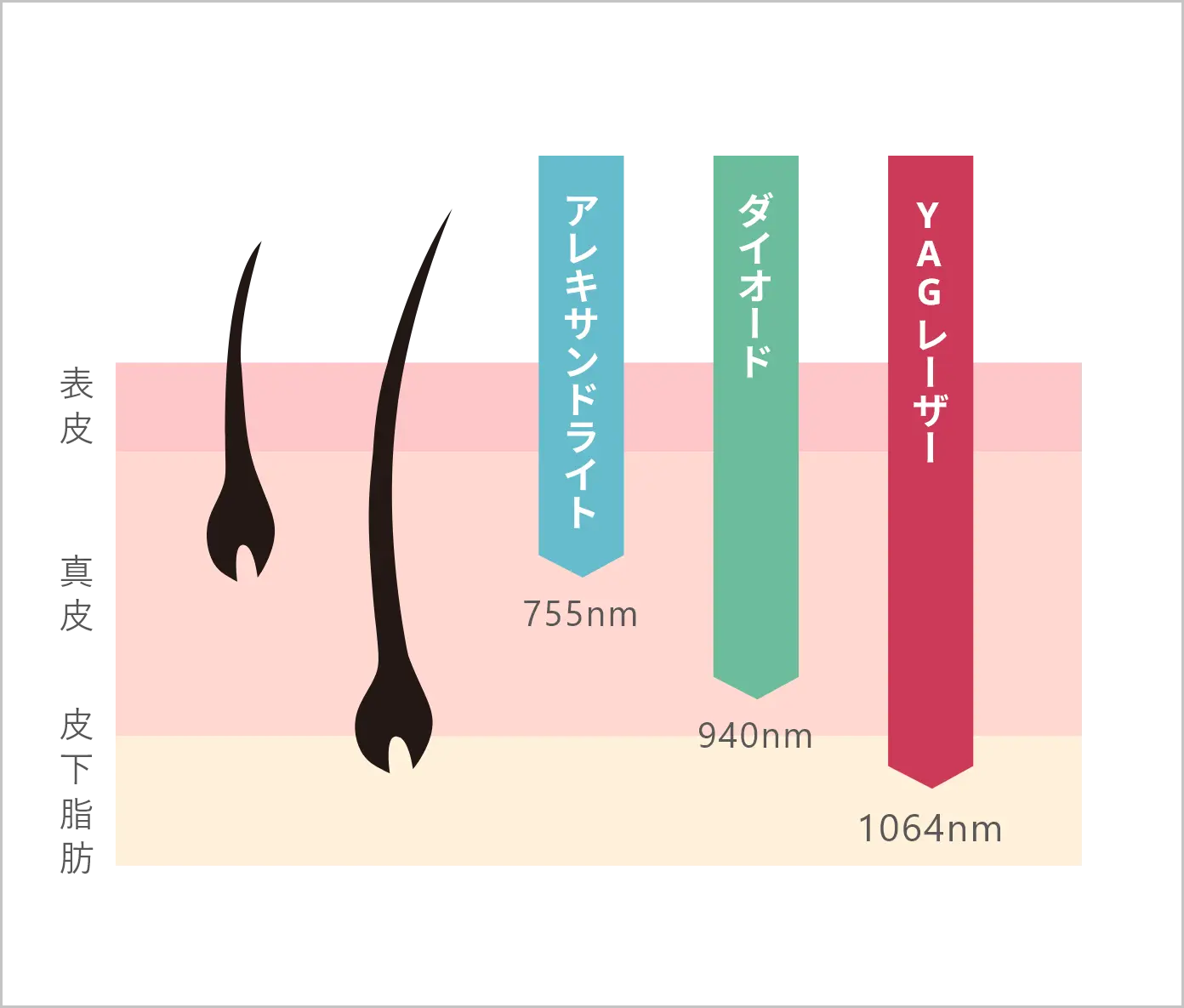 スプレンダーXの脱毛効果